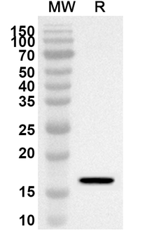 IL2 Rabbit Polyclonal Antibody