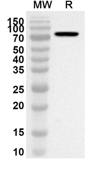 BIRC2 Rabbit Polyclonal Antibody