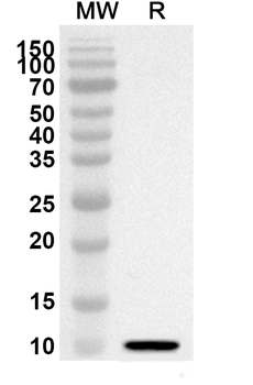 CD267/TNFRSF13B Rabbit Polyclonal Antibody