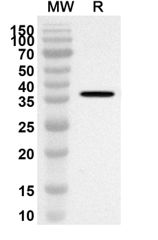 FZD5 Rabbit Polyclonal Antibody