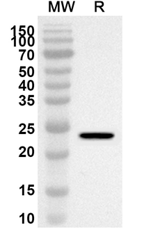 ULBP1 Rabbit Polyclonal Antibody