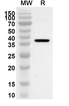 EDA2R Rabbit Polyclonal Antibody