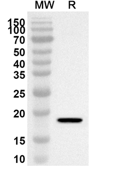 RNF43 Rabbit Polyclonal Antibody