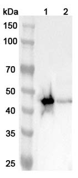 ASGR2 Rabbit Polyclonal Antibody