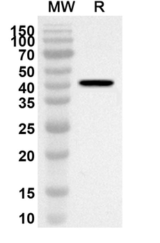 CD8A Rabbit Polyclonal Antibody