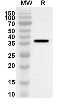 PAK6 Rabbit Polyclonal Antibody