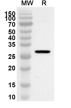 SECISBP2 Rabbit Polyclonal Antibody