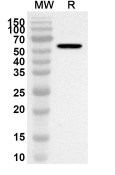 PEDV N/Nucleoprotein Rabbit Polyclonal Antibody
