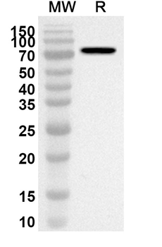 PEDV S2/Spike glycoprotein 2 Rabbit Polyclonal Antibody