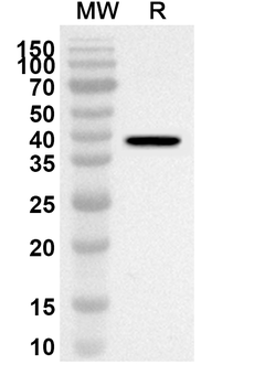 ARG1/Arginase-1 Rabbit Polyclonal Antibody