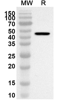 HCoV-229E NP/Nucleoprotein Rabbit Polyclonal Antibody