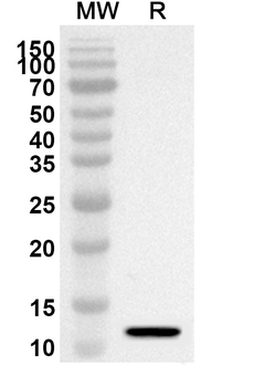 FRZB Rabbit Polyclonal Antibody