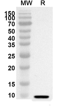 CCL28/MEC Rabbit Polyclonal Antibody