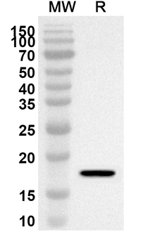 CD70 Rabbit Polyclonal Antibody
