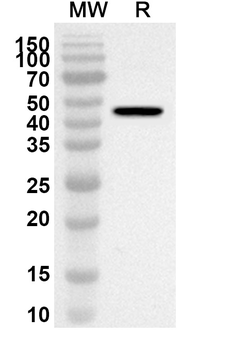 IFNAR1 Rabbit Polyclonal Antibody