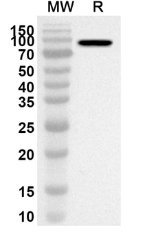 MDA5/IFIH1 Rabbit Polyclonal Antibody