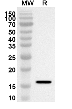 KISS1R Rabbit Polyclonal Antibody