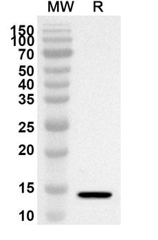 CPSF6 Rabbit Polyclonal Antibody