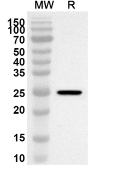 ALOX15B Rabbit Polyclonal Antibody
