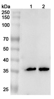 FCN1 Rabbit Polyclonal Antibody