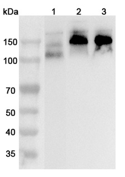 CD56/NCAM1 Rabbit Polyclonal Antibody