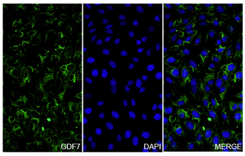 GDF7 Rabbit Polyclonal Antibody