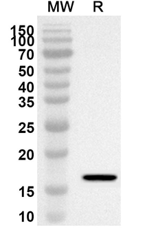 RBP2 Rabbit Polyclonal Antibody