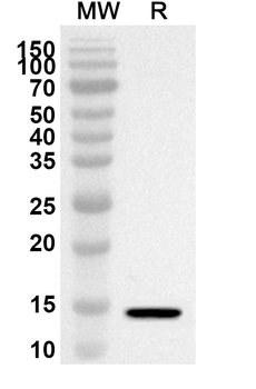DRD1 Rabbit Polyclonal Antibody