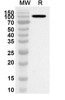 HAdV-5 L3/CP-H/Protein II Rabbit Polyclonal Antibody