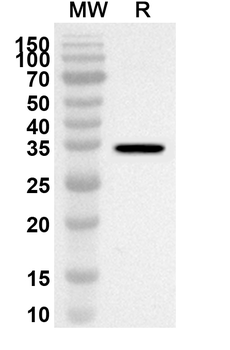 CCL4L1 Rabbit Polyclonal Antibody