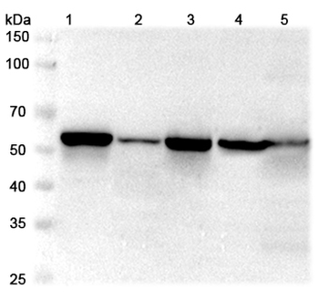 LMAN1 Rabbit Polyclonal Antibody