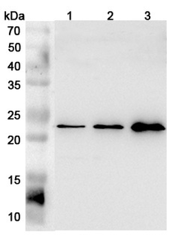 FGF21 Rabbit Polyclonal Antibody