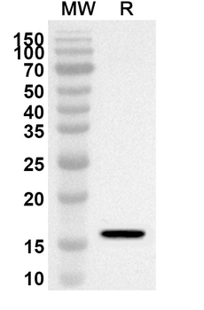 IL2 Rabbit Polyclonal Antibody