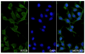 RTCB Rabbit Polyclonal Antibody