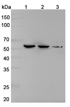 RTCB Rabbit Polyclonal Antibody