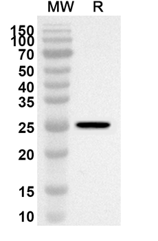 TWIST2 Rabbit Polyclonal Antibody