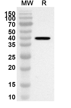 SAMM50 Rabbit Polyclonal Antibody