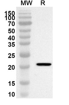 SNRPN Rabbit Polyclonal Antibody