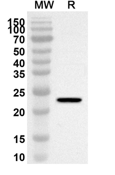 ELK1 Rabbit Polyclonal Antibody