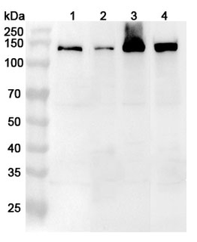 RBM10 Rabbit Polyclonal Antibody