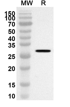 CTNND1 Rabbit Polyclonal Antibody
