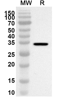 HSD3B2 Rabbit Polyclonal Antibody