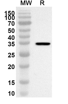TAOK1 Rabbit Polyclonal Antibody