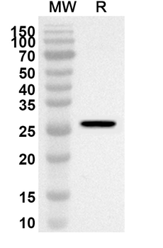 SUV39H2 Rabbit Polyclonal Antibody