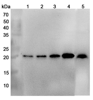 NDUFB10 Rabbit Polyclonal Antibody