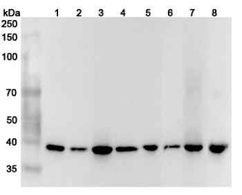 GIPC1 Rabbit Polyclonal Antibody