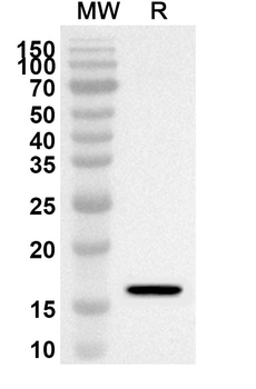 BTG1 Rabbit Polyclonal Antibody