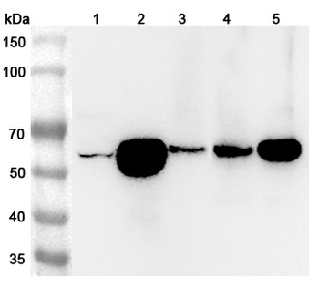 ATP6V1B2 Rabbit Polyclonal Antibody