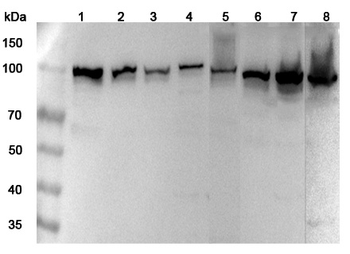 MTHFD1 Rabbit Polyclonal Antibody