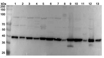 DNAJB11 Rabbit Polyclonal Antibody